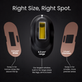 Sensilight™ ICE Cooled IPL Hair Removal
